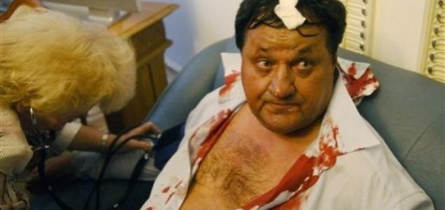 Krvava tučnjava u ukrajinskom parlamentu, jedan zastupnik u bolnici- VIDEO