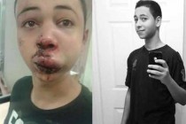 Neugodna situacija za Izrael: palestinski dječak, brutalno prebijen od strane izraelske policije, je američki državljanin iz Floride